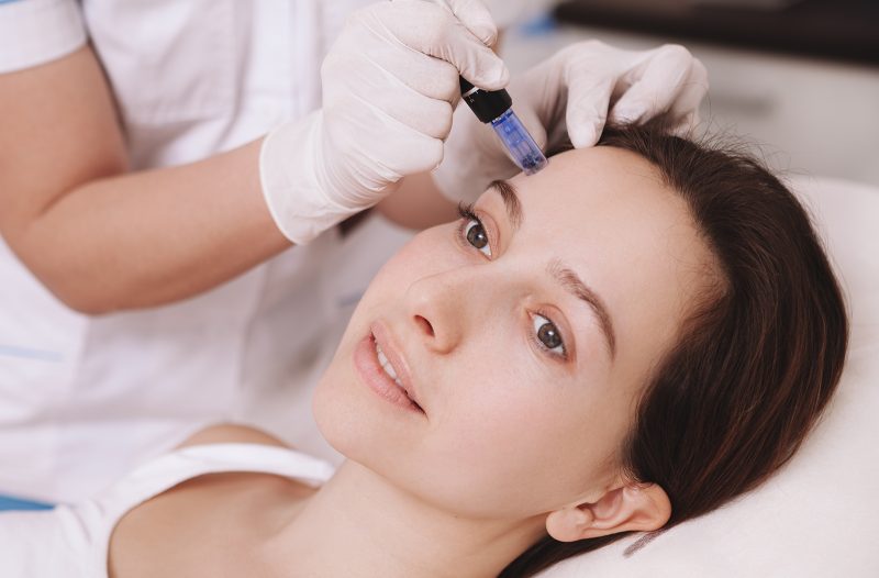 Koprivnica - grad-koprivnica.net - MICRONEEDLING – ŠTO JE I KAKO DJELUJE?
